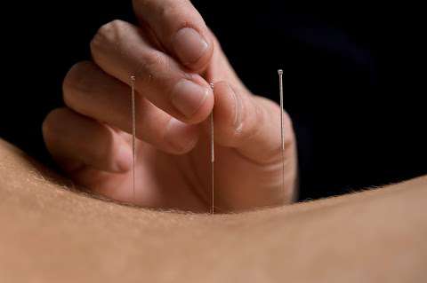 Julie Betts Acupuncture photo